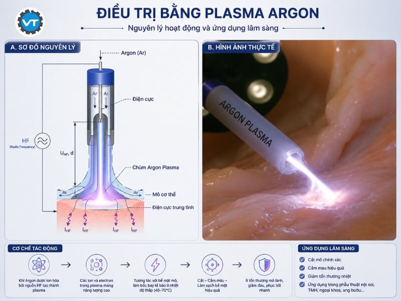 Điều trị y tế bằng Plasma Argon