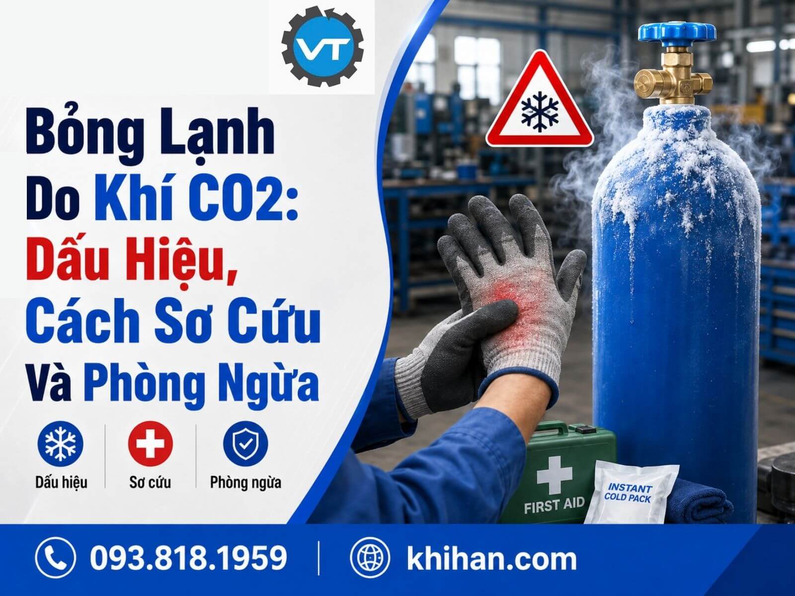 Bỏng lạnh do khí CO2: dấu hiệu và cách sơ cứu