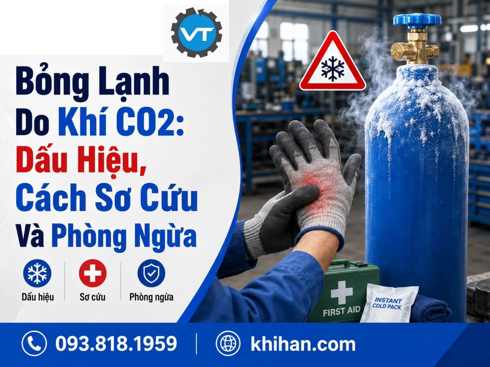 Bỏng Lạnh Do Khí CO2: Dấu Hiệu, Cách Sơ Cứu Và Phòng Ngừa