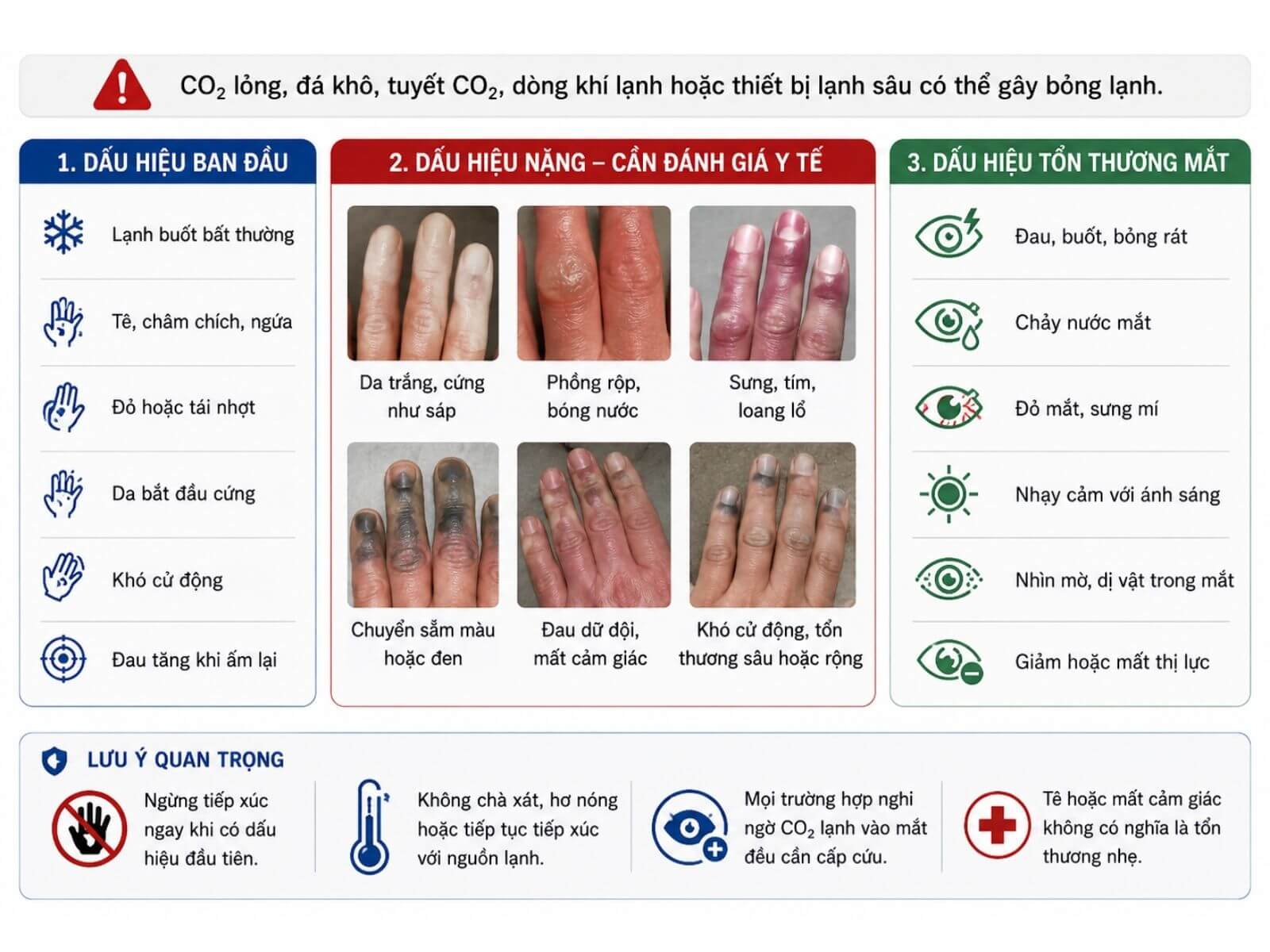Dấu hiệu nhận biết bỏng lạnh do khí CO2